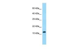 VKORC1 Rabbit anti-Human, Polyclonal, Novus Biologicals 0.1 mL | Buy Online | Novus Biologicals | Fisher Scientific
